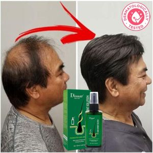 Hair Growth Serum Hair Grow Anti Hair Loss Serum 120ml hair tonic for growth Preventing Baldness hair loss treatment Herbal Care