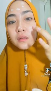 Krim SR12 Spot Essence Day Night Cream 10gr Mencerahkan Wajah Flek Hitam Bekas Jerawat