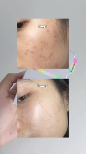 Tinh chất Serum Trắng Da Mờ Thâm Nám NUMBUZIN No 5+ Vitamin Concentrated Serum Làm trắng da 30ml