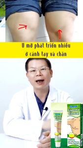 Kem Thảo Mộc Lipoma Sumifun 20g - Giúp Tan U Mỡ Bướu Mỡ Dưới Da U Mỡ Đa Hình Tụ Mỡ Cứng Hiệu Quả. Chiết Xuất Gừng Khô Nghệ Tây Bạch Chỉ. An Toàn Không Phẫu Thuật. Hỗ Trợ Giảm Sưng Tiêu U Nhanh Dễ Dùng Tại Nhà. | Moska Shop