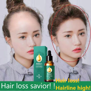 Ginger Hair Loss Solution Anti-hair loss and regrowth Increase Hair Density Leave-in Hair Treatment Oil 30ml Improves hair follicles Nourishes Hair Roots Frizzy Scalp Treatment Hair Care Serum