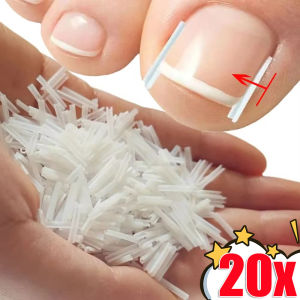 20ชิ้นการแก้ไขเล็บเท้ายาวเล็บบางเฉียบยืดหยุ่นแผ่นสติ๊กเกอร์ยืดเล็บร่องที่แก้ไขคุด