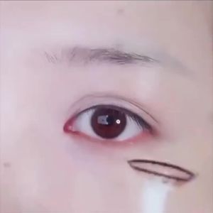 💗🙋♀️💗【2468人好评】怕光医用美容虹膜盲片角膜遮光遮瑕眼睛年抛1片