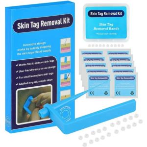 NEW Skin Tags Remover Tool 2-in-1 Auto Fast Removal Kit Safe Auto Tags Removal Pen with Bands 2-8mm Skin Tag Face Skin Care Tool