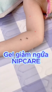 NIPCARE MILD ITCH RELIEF GEL (15g) - Gel giảm ngứa dùng cho bé bị mẩn ngứa hăm tãchàm sữa.