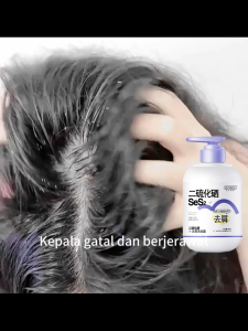 Shampo Selenium Disulfida – Anti Ketombe Ampuh Kurangi Rambut Rontok & Kontrol Minyak