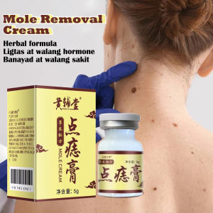 Concentrated Potent Skin Removal Cream Body Warts Cream Spot Mole Ointment