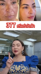 COD ซื้อ 4 แถม 5 ฟรี 【มาสก์หน้าก่อน แล้วค่อยทาครีม】377 ครีมบำรุงผิว ช่วยให้ผิวดูกระจ่างใส เพิ่มความชุ่มชื้น เพื่อผิวสุขภาพดี มาส์กหน้า 1 กล่อง 5 ชิ้น