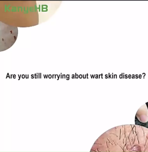 Kem Mụn Lưng Tàn Nhang Nám Chính Hãng Hỗ Trợ Làm Mờ Đốm Nâu Chăm Sóc Da Sáng Mịn An Toàn Dễ Sử Dụng Cho Mọi Người
