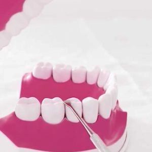 ชุดขูดหินปูน 6 ชิ้น อุปกรณ์ทำความสะอาดฟัน ชุดอุปกรณ์ทำความสะอาดช่องปาก พร้อมกล่องใส่อย่างดี Dee CoffeeTH