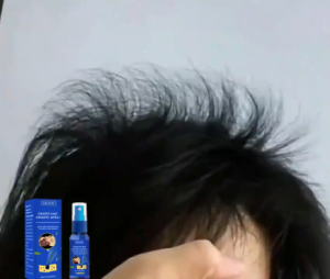 EELHOE Rambut Pertumbuhan Semprotan Cairan Natural Tumbuhan Perawatan Kebotakan Mempromosikan Regenerasi Rambut Universal Untuk Pria Dan Wanita