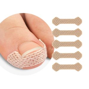 10-100 PCS  Nail Correction Stickers Ingrown Toenail Corrector Patches Paronychia Treatment Recover Corrector Pedicure Tools