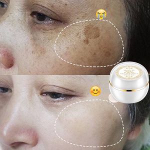 Face Whitening Cream Moisture Hydra Makeup Base Cream Moisturizer Lady Cream/Lady Fair Cream (30g) siang dan malam putihkan kulit pudarkan jeragat kecilkan pori kawal minyak cerahkan kulit For Dark Skin Spots Scars Snow White Cream滋养遮瑕淡斑 贵妇膏