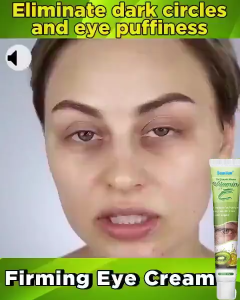 "Fat Granules Remover Eye Cream Effective Remove Fat Granules Puffiness Anti-Particles Milia Remover Product Repair Eye Skin Care"