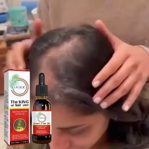Minyak Esensial Penumbuh Rambut Mengurangi Kerontokan Rambut Perawatan Rambut Ekstrak Ginseng