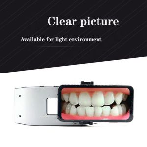Dental LED Intraoral Photography Light Oral Filling Lamp for Dentist Treatment Tool