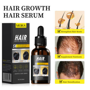 Pertumbuhan rambut penumbuh rambut cepat Ginger King Serum Anti Botak penumbuh rambut Penumbuh Rambut Secara Cepat Penyubur Rambut Rontok Pria
