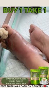 Insulin Tea Herbal Miracle tea Diabetic BloodSugar Highblood Kidney Faillure Rayuma Gout**