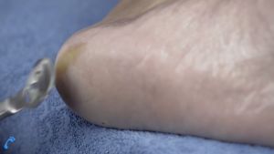 [READY STOCK !!!] Penghalus Tumit Kaki / Penghalus Kaki Manual Untuk Kulit Mati Dan Kapalan / Callus Remover Pedicure Menicure Alat Pembersih Kapalan Kerokan Kaki Pisau Penghilang Kulit Mati Kaki Anti Kasar Pedicure Credo Soligen BISA COD MURAH TERMURAH