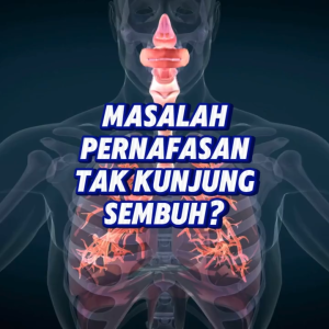 Etawaku Platinum Less Sugar - Susu Etawa Murni Rendah Gula Sembuhkan Masakah Pernafasan Sesak Nafas dan Asma Original Official Store