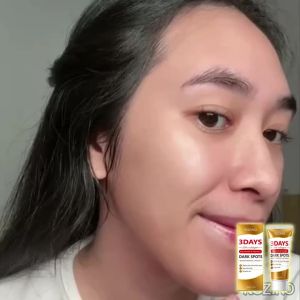 Kem Làm Sáng Lỗ Chân Lông 3 Ngày Với Collagen Niacinamide & Vitamin C - Giảm Thâm Se Khít Lỗ Chân Lông Làm Sáng Da Cho Mọi Loại Da