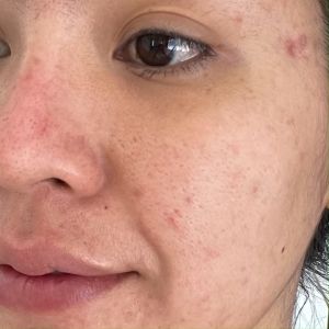 FRAIS LABO White VC Serum เฟรซ ลาโบะ ไวท์ วีซี เซรั่ม ให้ผิวกระจ่างใสจากญี่ปุ่น