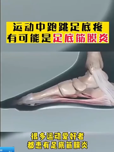 Heel pain relief patch 足跟痛 plantar fasciitis pain relief | Heel Bone Spurs 12pcs/box Soothes Heel & Instep Discomfort