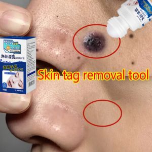 7 days Removes mole essence Whitening Dark Spot Freckle Facial Skin Care Serum 无痛无痕去痣 Highly effective skin lightening serum Skin tag remover Mole remover Mole lightening Facial skin care serum 30ml