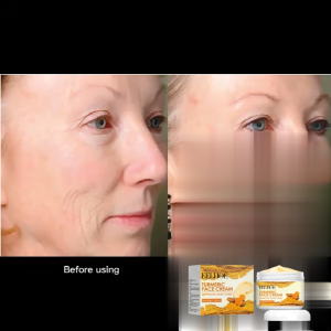 EELHOE Turmeric face cream evens skin tone soothes dullness moisturizes and brightens