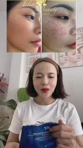 COMBO 5 MIẾNG mặt nạ xanh sennio hàn quốc mặt nạ chỉ tơ tằm sennio chính hãng màu xanh biển super soothing healing mask cấp ẩm tái tạo phục hồi da mặt