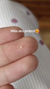 Serum Khusus Milia: Serum AHA BHA Leika Skincare