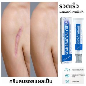 ครีมกําจัดรอยแผลเป็นจากธรรมชาติซ่อมแซมอย่างรวดเร็วของรอยแผลเป็นเก่าใหม่ จุดระเบิดการรักษาจากธรรมชาติทั้งหมดด้วยเชียบัตเตอร์ Centella Asiatica