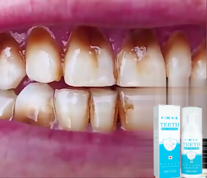 Kem đánh răng làm trắng răng làm trắng răng kem đánh răng mousse làm sạch răng chăm sóc vệ sinh răng miệng loại bỏ mảng bám và mùi hôi miệng