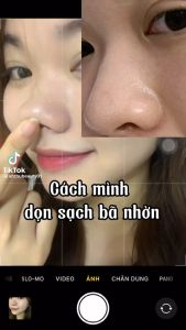 Máy hút mụn cầm tay thiết kê nhỏ gọn có khoang chứa nước tinh khiết làm sạch sâu lỗ chân lông làm sạch mụn cám mụn đầu đen