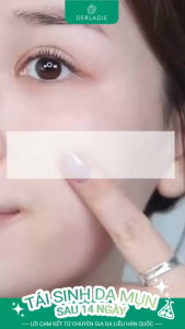 Nước Tẩy Trang Thuần Chay Sạch Dịu Êm Cho Da Dầu Mụn Derladie Cleansing Water Witch Hazel Micellar Unsented 500ML