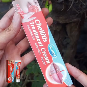 OUHOE Cheilitis Treatment Cream Moisturize And Hydrate The Lips Cold Sores Lip Inflammation Rehydration Chapped Labia Lips Herpes Ointment 20g