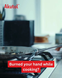 Akutol Burn Spray™ | Spray Luka Melecur Ringan / Minor Burn Relief Spray | Rawat Cepat Luka Melecur & Sunburn | Fast Care for Burns & Sunburn | 100% Original Aveflor (50ml)