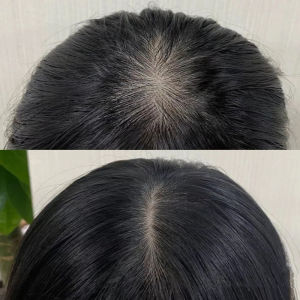 Ginger Fast Hair Growth Serum Preventing Hair Lose Liquid Repair Damaged Hair Hair Growth Essential Oil Conditioner Care Essence 20ML Improve hair follicles Nourishing Hair root Thinning Hair Treatment Promotes Thicker Hair Regrowth