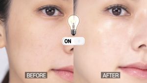 Serum Loại Bỏ Nám Tầng Sâu Và Phục Hồi Tái Tạo Da Ngừa Dãn Mao Mạch Ngừa Mẩn Đỏ Vùng Chũ T SkinMD Pure Whitenol Serum 50ml