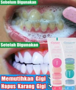 Pasta Gigi Macaron Korea Memutihkan Gigi / Cherry Blueberry Lime Peach Whitening Toothpaste 100g