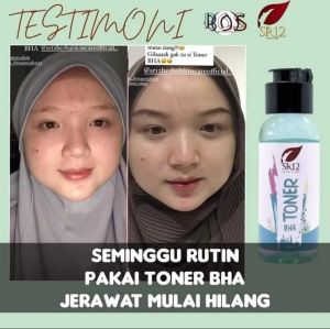 Toner BHA SR12 - Toner Kulit Beruntusan & Jerawat SR12 - Toner Eksfoliasi Wajah Angkat Sel Kulit Mati SR12