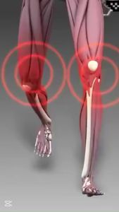 FREE GIFT COMBO Bee Venom Bone And Joint Cream Repair Relieves Joint Discomfort Portable Massage External Application Care Cream Knee Neck Back Pain Relief Counterpain Cream Relieve Stiffness Muscle Personal Health Care(30g)