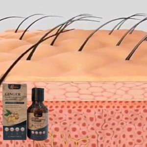 RODIL Ginger Hair growth Shampoofor dandruff and itchingDeep cleansingScalp nourishing and hair beautifying shampoo™