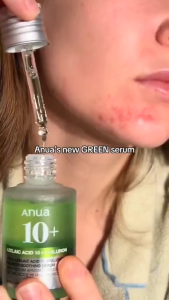 Anua Azelaic Acid 10 + Hyaluron Redness Soothing Serum 30ml – Hydrating & Clarifying Facial Serum