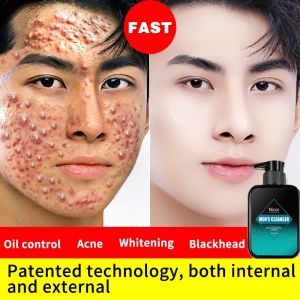 Pembersih wajah pria Menghilangkan komedo dan jerawat mengontrol minyak Pemutih-Wajah Pria melembabkan Pori-pori bersih dalam 150g