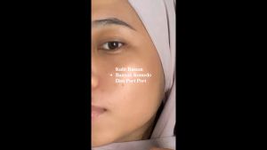 gmeelan 4d centella masker wajah mengencangkan kulit mencerahkan mengurangi noda bekas jerawat