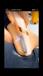 Portable Automatic Foot Peeling & Callus Grinding Device