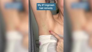 Topicals High Roller Ingrown Hair Serum    Roll-on Tonic to Soothe and Calm Irritated Skin on Face Armpits and Bikini Areas    Contains Salicylic and Glycolic Acid    Vegan and Cruelty-Free (1.7 Fl Oz)