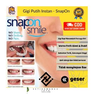 COCOK UNTUK SEMUA BENTUK GIGI !!! | Snap On Smile Gigi Palsu Atas Bawah Pria Wanita