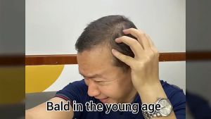 Dexe Hair Building Thickening Fibers Powder Black Hairline Shadow Powder Hair Fiber Black Quickly Cover Hair Loss Hair Concealer Power Hair Root Fluffy Power Hair Powder 22g